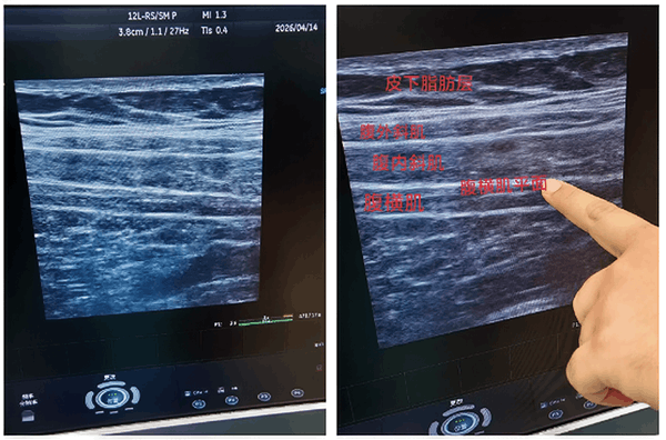 ������λ�¸��ἡƽ�����ͼ���